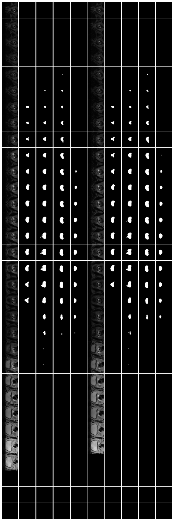 Results of sample from validation set