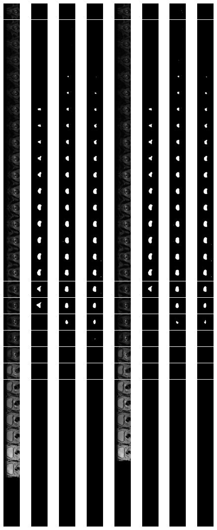 Results of sample from validation set